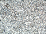 SAR1B Antibody in Immunohistochemistry (Paraffin) (IHC (P))