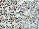 SAR1B Antibody in Immunohistochemistry (Paraffin) (IHC (P))