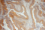 SAR1B Antibody in Immunohistochemistry (Paraffin) (IHC (P))