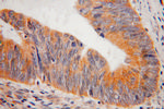 SAR1B Antibody in Immunohistochemistry (Paraffin) (IHC (P))