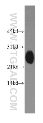 SAR1B Antibody in Western Blot (WB)