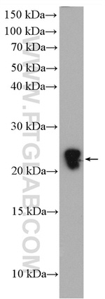 SAR1B Antibody in Western Blot (WB)