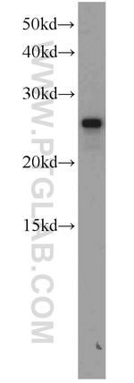 SAR1B Antibody in Western Blot (WB)