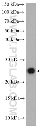 SAR1B Antibody in Western Blot (WB)
