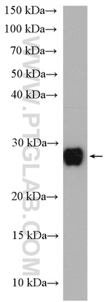 SAR1B Antibody in Western Blot (WB)