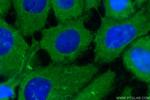 S100A2 Antibody in Immunocytochemistry (ICC/IF)