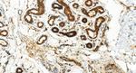 S100A2 Antibody in Immunohistochemistry (Paraffin) (IHC (P))