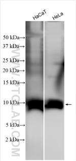 S100A2 Antibody in Western Blot (WB)