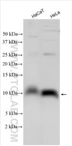 S100A2 Antibody in Western Blot (WB)