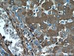 TNIP2 Antibody in Immunohistochemistry (Paraffin) (IHC (P))