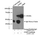 TNIP2 Antibody in Immunoprecipitation (IP)
