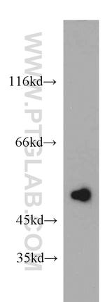 TNIP2 Antibody in Western Blot (WB)