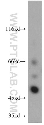 TNIP2 Antibody in Western Blot (WB)