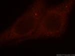 DLC1 Antibody in Immunocytochemistry (ICC/IF)