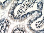 RPP25 Antibody in Immunohistochemistry (Paraffin) (IHC (P))