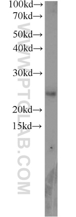 RPP25 Antibody in Western Blot (WB)
