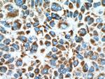 MDH2 Antibody in Immunohistochemistry (Paraffin) (IHC (P))