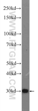 MDH2 Antibody in Western Blot (WB)