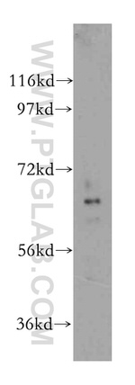 HIP14/ZDHHC17 Antibody in Western Blot (WB)