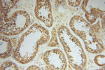 HIP14/ZDHHC17 Antibody in Immunohistochemistry (Paraffin) (IHC (P))