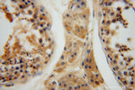 HIP14/ZDHHC17 Antibody in Immunohistochemistry (Paraffin) (IHC (P))