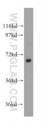 HIP14/ZDHHC17 Antibody in Western Blot (WB)