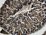 CYB5B Antibody in Immunohistochemistry (Paraffin) (IHC (P))