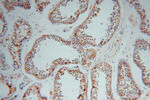 CYB5B Antibody in Immunohistochemistry (Paraffin) (IHC (P))