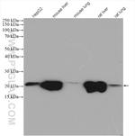 CYB5B Antibody in Western Blot (WB)