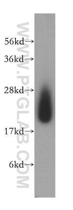 CYB5B Antibody in Western Blot (WB)