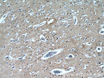 LIMD2 Antibody in Immunohistochemistry (Paraffin) (IHC (P))