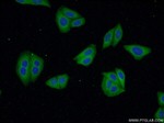 VPS24 Antibody in Immunocytochemistry (ICC/IF)
