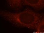 YIPF4 Antibody in Immunocytochemistry (ICC/IF)