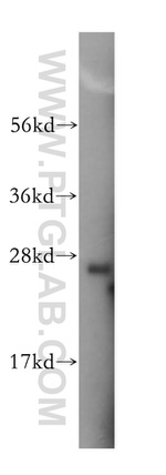 YIPF4 Antibody in Western Blot (WB)