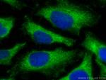 NAT6/FUS2 Antibody in Immunocytochemistry (ICC/IF)