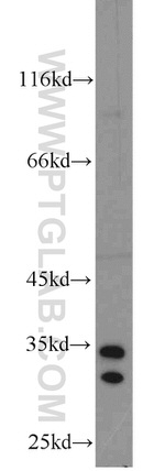 THTPA Antibody in Western Blot (WB)