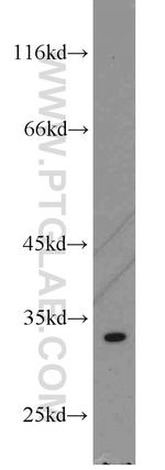THTPA Antibody in Western Blot (WB)