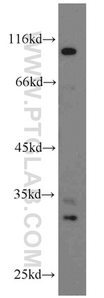 THTPA Antibody in Western Blot (WB)