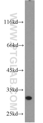 THTPA Antibody in Western Blot (WB)
