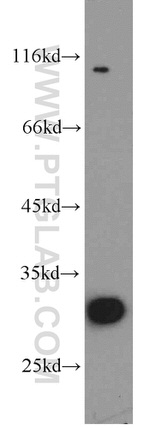 THTPA Antibody in Western Blot (WB)