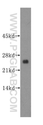 THTPA Antibody in Western Blot (WB)