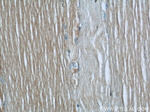 UBE2E3 Antibody in Immunohistochemistry (Paraffin) (IHC (P))