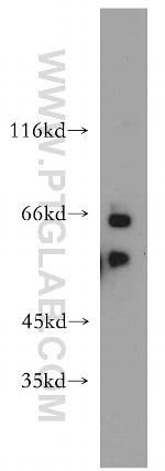 CPSF6 Antibody in Western Blot (WB)