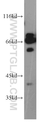 CPSF6 Antibody in Western Blot (WB)