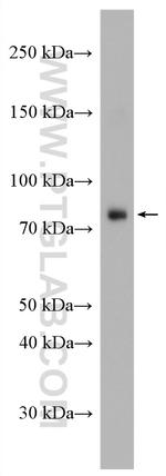 OSBPL10 Antibody in Western Blot (WB)