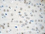 RUNX1T1 Antibody in Immunohistochemistry (Paraffin) (IHC (P))
