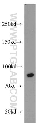 RUNX1T1 Antibody in Western Blot (WB)
