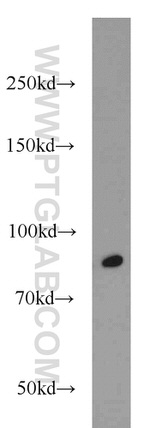 RUNX1T1 Antibody in Western Blot (WB)