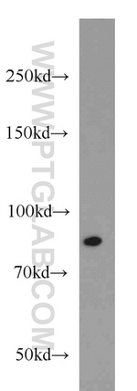 RUNX1T1 Antibody in Western Blot (WB)