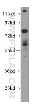 RUNX1T1 Antibody in Western Blot (WB)
